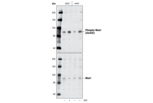 Western blot analysis of extracts from A431 and H441 cells, untreated or EGF-treated, using Phospho-Wee1 (Ser642) (D47G5) Rabbit mAb (upper) or Wee1 Antibody #4936 (lower).