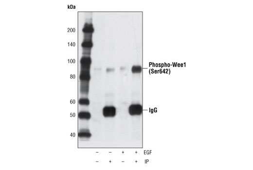 Immunoprecipitation of phospho-wee1 from A431 cells, untreated or EGF-treated, using Phospho-Wee1 (Ser642) (D47G5) Rabbit mAb followed by Western blot using the same antibody.