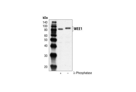 Western blot analysis of extracts from HeLa cells, untreated or Lambda Phosphatase-treated NEB #P0753 (10,000 units/ml for 1h), using Wee1 Antibody.