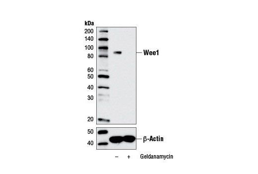 Western blot analysis of extracts from HeLa cells, untreated (-) or treated with Geldanamycin #9843 (+), using Wee1 (D10D2) Rabbit mAb (upper) and β-Actin (D6A8) Rabbit mAb #8457 (lower).