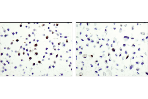 Immunohistochemical analysis of paraffin-embedded HT-29 (left) or PC-3 (right) cell pellets using Wee1 (D10D2) Rabbit mAb.