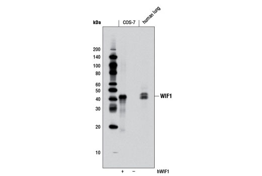 Western blot analysis of extracts from COS-7 cells, transfected with a human WIF1 construct (+) or mock-transfected (-), and normal human lung using WIF1 (D50F9) Rabbit mAb.