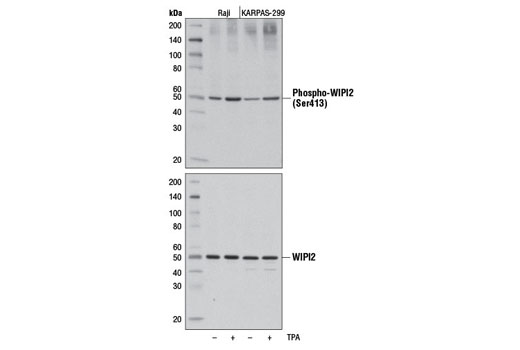 Western blot analysis of extracts from Raji and KARPAS-299 cells, untreated (-) or treated with TPA #4174 (200 nM, 30 min; +) using Phospho-WIPI2 (Ser413) Antibody (upper) or total WIPI2 Antibody #8567 (lower).