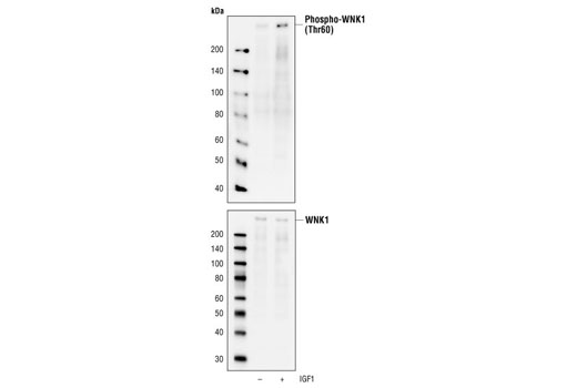 Western blot analysis of extracts from HT29 cells, untreated or IGF1-treated (100 ng/ml for 30 minutes), using Phospho-WNK1 (Thr60) Antibody (upper) or WNK1 Antibody #4979 (lower).