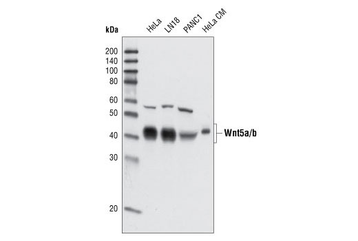 Western blot analysis of total cell lysates from HeLa, LN18, PANC1 cells and HeLa cells conditioned medium (CM) using Wnt5a/b (C27E8) Rabbit mAb.