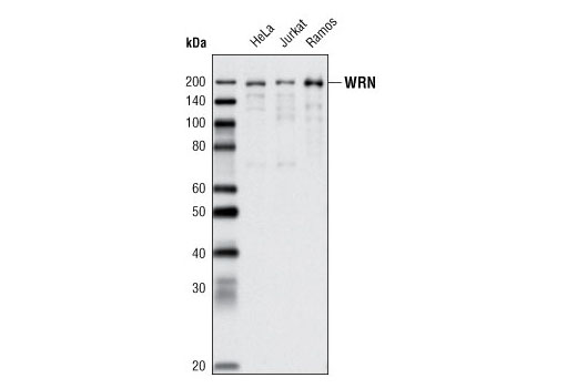Western blot analysis of HeLa, Jurkat, and Ramos cell extracts using WRN (8H3) Mouse mAb.