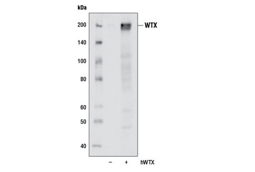 Western blot analysis of extracts from HeLa cells, untransfected or transfected with a contruct overexpressing human WTX, using WTX (D38E5) Rabbit mAb.