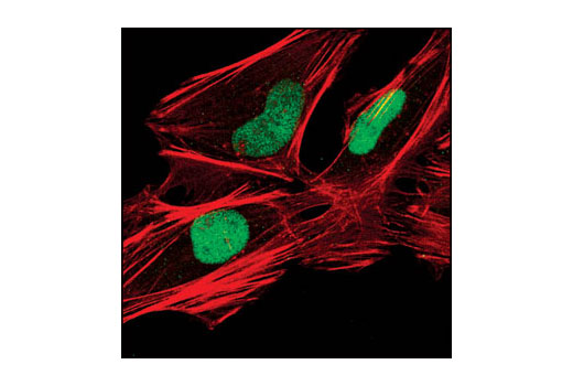 Confocal immunofluorescent analysis of HeLa cells using XRCC1 Antibody (green). Actin filaments have been labeled with Alexa Fluor ® 555 phalloidin (red).