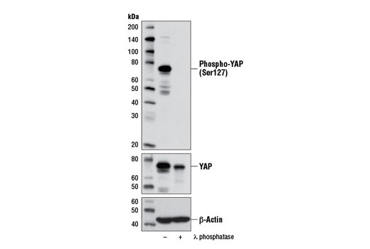 Western blot analysis of extracts from PANC-1 cells, untreated (-) or λ-phosphatase-treated (+), using Phospho-YAP (Ser127) (D9W2I) Rabbit mAb (upper), YAP Antibody #4912 (middle), and β-Actin (D6A8) Rabbit mAb #8457 (lower).