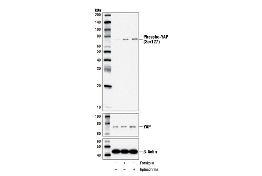 Western blot analysis of MDA-MB-231 cells, vehicle-treated (-) or treated with Forskolin #3828 (10 μM, 60 min; +) or epinephrine (10 μM, 60 min; +), using Phospho-YAP (Ser127) (D9W2I) Rabbit mAb (upper), YAP Antibody #4912 (middle), and β-Actin (D6A8) Rabbit mAb #8457 (lower). Note the induction of YAP (Ser127) phosphorylation after treatment with forskolin or epinephrine, consistent with the findings reported in Xu et al . (2012) [9].