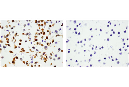 Immunohistochemical analysis of paraffin-embedded cell pellets, A-204 (left) and RL-7 (right), using Phospho-YAP (Ser127) (D9W2I) Rabbit mAb.