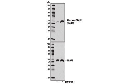 Western blot analysis of extracts from THP-1 cells differentiated with TPA #4174 (80 nM, overnight), and then either untreated (-) or transfected with poly(dA:dT) (0.004 U/ml; 7 hr; +), using Phospho-TRAF2 (Ser11) (E2B6L) Rabbit mAb (upper) or TRAF2 (C192) Antibody #4724 (lower).