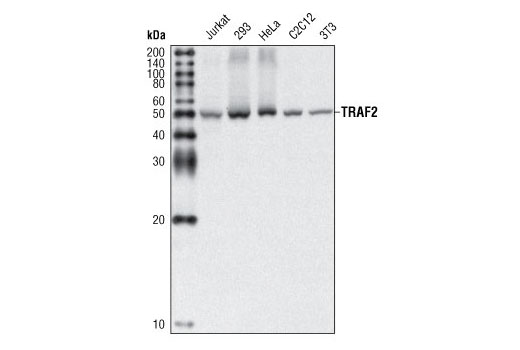 Western blot analysis of extracts from Jurkat, 293, HeLa, C2C12, and NIH/3T3 cells, using TRAF2 (C192) Antibody.