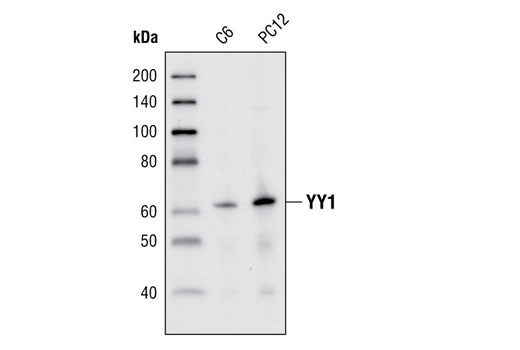 Western blot analysis of total cell lysates from C6 and PC12 cells, using YY1 (13G10) Rabbit mAb.