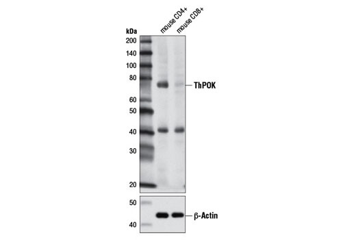 Western blot analysis of mouse CD4+ T cells and mouse CD8+ T cells using ThPOK (D9V5T) Rabbit mAb (upper) and β-Actin (D6A8) Rabbit mAb #8457 (lower).