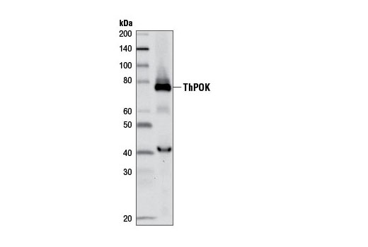 Western blot analysis of human CD4+ T cells using ThPOK (D9V5T) Rabbit mAb.