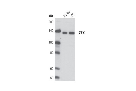 Western blot analysis of extracts from HL-60 and iPS cells using ZFX (L28B6) Mouse mAb.