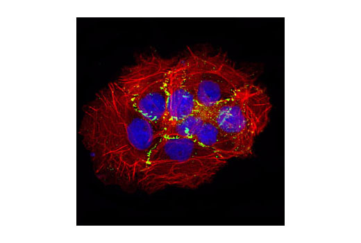 Confocal immunofluorescent analysis of A431 cells using ZO-2 Antibody (green). Actin filaments have been labeled with DY-554 phalloidin (red). Blue pseudocolor = DRAQ5™ (fluorescent DNA dye).