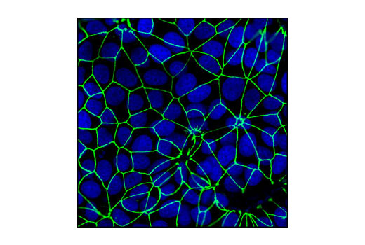 Confocal immunofluorescent analysis of MCF-7 cells using ZO-3 (D57G7) XP ® Rabbit mAb (green). Blue pseudocolor = DRAQ5 ® #4084 (fluorescent DNA dye).