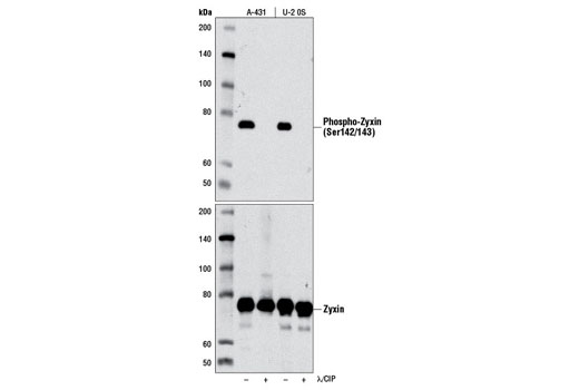 Western blot analysis of extracts from A-431 and U-2 OS cells, untreated (-) or treated (+) with λ and calf intestinal phosphatase (λ/CIP), using Phospho-Zyxin (Ser142/143) (D1E8) Rabbit mAb (upper) or Zyxin Antibody #3553 (lower).