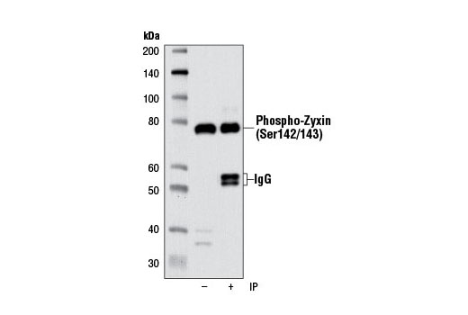 Immunoprecipitation of extracts from A-431 cells using Phospho-Zyxin (Ser142/143) (D1E8) Rabbit mAb. Western blot was performed using the same antibody. Lane 1 is 10% input.