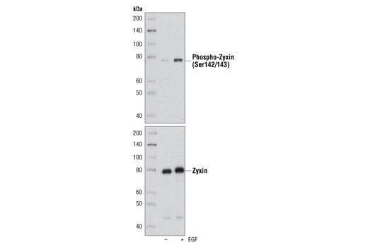 Western blot analysis of extracts from A-431 cells, untreated (-) or EGF-treated (30 min; +), using Phospho-Zyxin (Ser142/143) Antibody (upper) and Zyxin Antibody #3553 (lower).