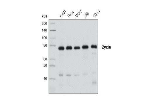 Western blot analysis of extracts from various cell lines using Zyxin Antibody.