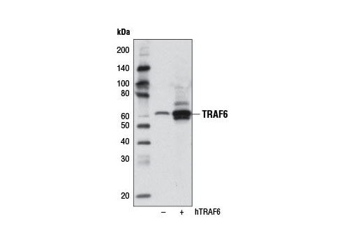 Western blot analysis of extracts from 293T cells, either mock transfected (-) or transfected with a cDNA expression construct encoding full-length human TRAF6 (+), using TRAF6 (D21G3) Rabbit mAb.