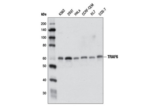 Western blot analysis of extracts from various cell lines using TRAF6 (D21G3) Rabbit mAb.