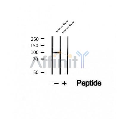 Western blot analysis of extracts of mouse liver tissue, using STT3B antibody.