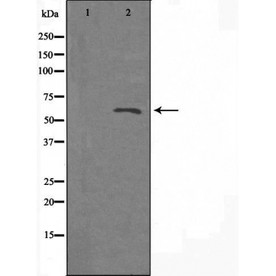 Western blot analysis of extracts from Jurkat cells, using A26B1 antibody.