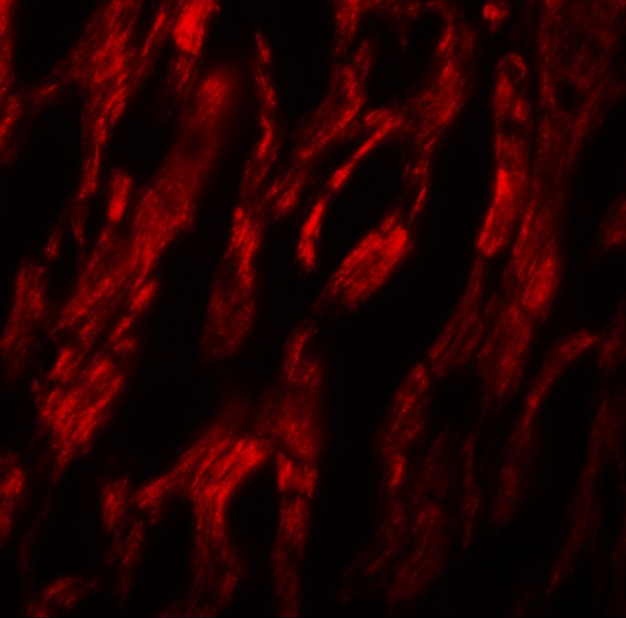 ARG54920 anti-ATG9A antibody IHC image Immunohistochemistry: ATG9A in human heart tissue stained with ARG54920 anti-ATG9A antibody at 20 ug/ml dilution.