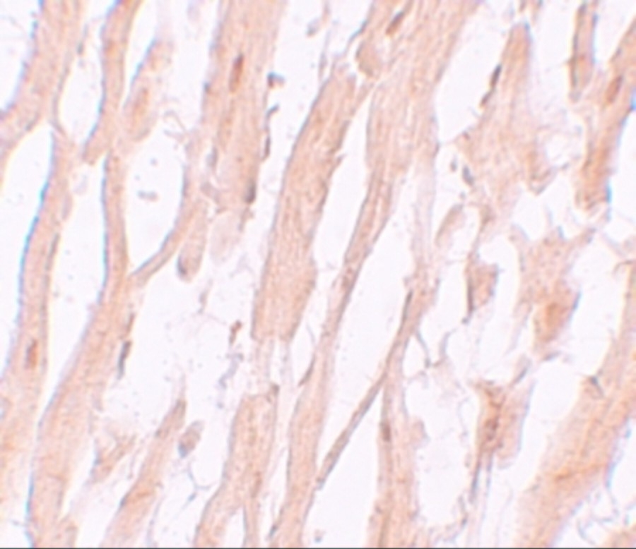 ARG54920 anti-ATG9A antibody IHC image Immunohistochemistry: ATG9A in human heart tissue stained with ARG54920 anti-ATG9A antibody at 5 ug/ml dilution.
