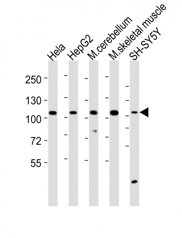 ARG55261 anti-LGR5 / GPR49 antibody WB image Western blot: 20 μg of 1) HeLa whole cell lysates, 2) HepG2whole cell lysates, 3) mouse cerebellum lysates, 4) mouse skeletal muscle lysates, 5) SH-SY5Y whole cell lysates stained with ARG55261 anti-LGR5 / GPR49 antibody at 1:2000 dilution.