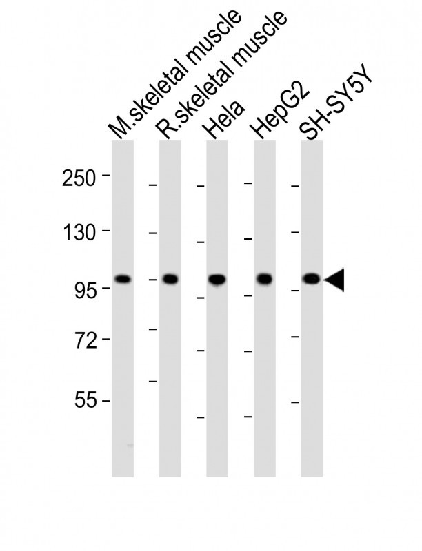 ARG55261 anti-LGR5 / GPR49 antibody WB image Western blot: 20 μg of 1) mouse skeletal muscle lysates, 2) rat skeletal muscle lysates, 3) Hela whole cell lysates, 4) HepG2 whole cell lysates, 5) SH-SY5Y whole cell lysates stained with XXXXX at 1:2000 dilution. Blocking/Dilution buffer: 5% NFDM/TBST.