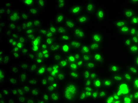 ARG55204 anti-PAX6 antibody ICC/IF image Immunofluorescence: A549 cell stained with ARG55204 anti-PAX6 antibody.