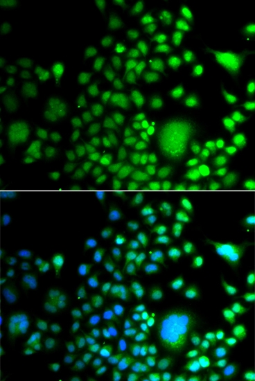 ARG55204 anti-PAX6 antibody ICC/IF image Immunofluorescence: A549 cell stained with ARG55204 anti-PAX6 antibody. Blue: DAPI for nuclear staining.
