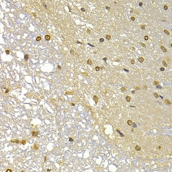 ARG55205 anti-S100A4 antibody IHC image Immunohistochemistry: paraffin-embedded rat brain stained with ARG55205 anti-S100A4 antibody at 1:100 dilution.