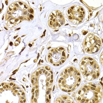 ARG55205 anti-S100A4 antibody IHC image Immunohistochemistry: paraffin-embedded human breast stained with ARG55205 anti-S100A4 antibody at 1:100 dilution.