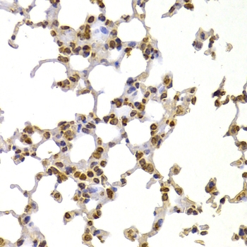 ARG55205 anti-S100A4 antibody IHC image Immunohistochemistry: paraffin-embedded mouse lung stained with ARG55205 anti-S100A4 antibody at 1:100 dilution.