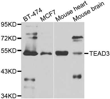 ARG55100 anti-TEAD3 antibody WB image Western Blot: extracts of various cell lines stained with ARG55100 anti-TEAD3 antibody.