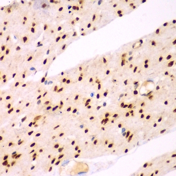 ARG55100 anti-TEAD3 antibody IHC image Immunohistochemistry: paraffin-embedded human colon stained with ARG55100 anti-TEAD3 antibody at 1:100 dilution.