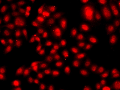 ARG55100 anti-TEAD3 antibody ICC/IF image Immunofluorescence: A549 cell stained with ARG55100 anti-TEAD3 antibody.