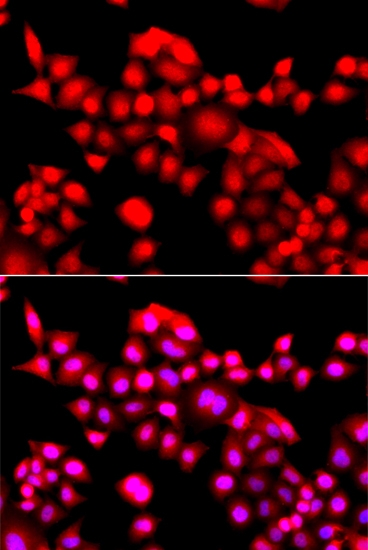 ARG55100 anti-TEAD3 antibody ICC/IF image Immunofluorescence: A549 cell stained with ARG55100 anti-TEAD3 antibody. Blue: DAPI for nuclear staining.