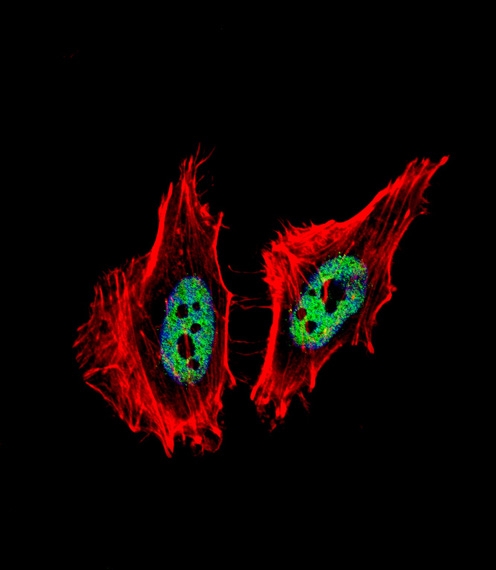 ARG55565 anti-CtBP1 antibody ICC/IF image Immunofluorescence: HeLa cell stained with ARG55565 anti-CtBP1 antibody (green) at 1:25 dilution, 1 h at 37°C. HeLa cells were fixed with 4% PFA (20 min), permeabilized with Triton X-100 (0.1%, 10 min), then incubated with ARG55565 anti-CtBP1 antibody. Cytoplasmic actin was counterstained with Alexa Fluor® 555 (red) conjugated Phalloidin (7units/ml, 1 h at 37°C). Nuclei were counterstained with DAPI (blue) (10 ug/ml, 10 min).CTBP1 immunoreactivity is localized to nucleus significantly.|.