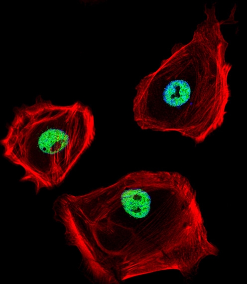 ARG55565 anti-CtBP1 antibody ICC/IF image Immunofluorescence: SK-BR-3 cell stained with ARG55565 anti-CtBP1 antibody (green) at 1:25 dilution, 1 h at 37°C. SK-BR-3 cells were fixed with 4% PFA (20 min), permeabilized with Triton X-100 (0.1%, 10 min), then incubated with ARG55565 anti-CtBP1 antibody. Cytoplasmic actin was counterstained with Alexa Fluor® 555 (red) conjugated Phalloidin (7units/ml, 1 h at 37°C). Nuclei were counterstained with DAPI (blue) (10 ug/ml, 10 min).CTBP1 immunoreactivity is localized to nucleus significantly.|.