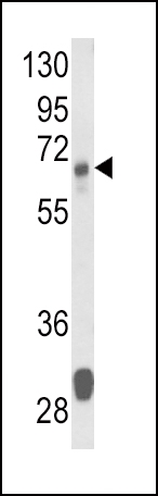 ARG55696 anti-Glutaminase antibody WB image Western blot: 35 µg of Mouse liver tissue lysates stained with ARG55696 anti-Glutaminase antibody.