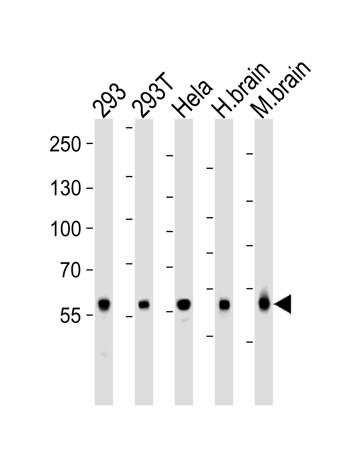 ARG55696 anti-Glutaminase antibody WB image Western blot: 35 µg of 293, 293T, HeLa cell line , huamn brain and Mouse brain tissue lysate (from left to right) stained with ARG55696 anti-Glutaminase antibody at 1:1000 dilution.