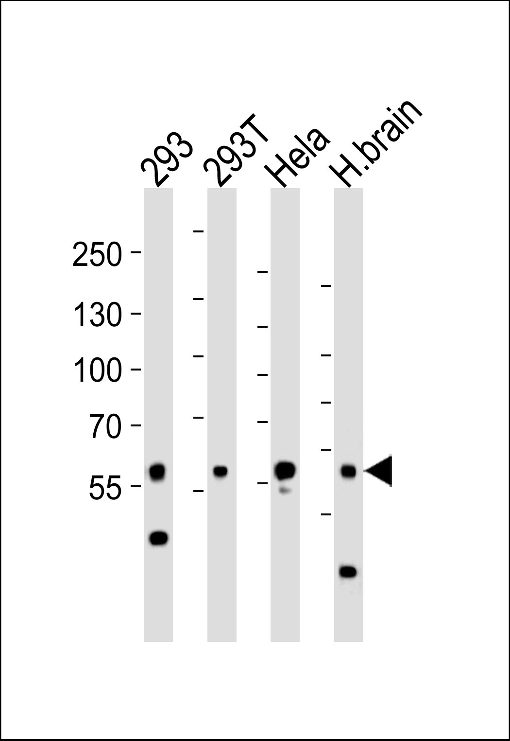 ARG55696 anti-Glutaminase antibody WB image Western blot: 35 µg of 293, 293T, HeLa cell line and Human brain tissue lysate (from left to right) stained with ARG55696 anti-Glutaminase antibody at 1:1000 dilution.