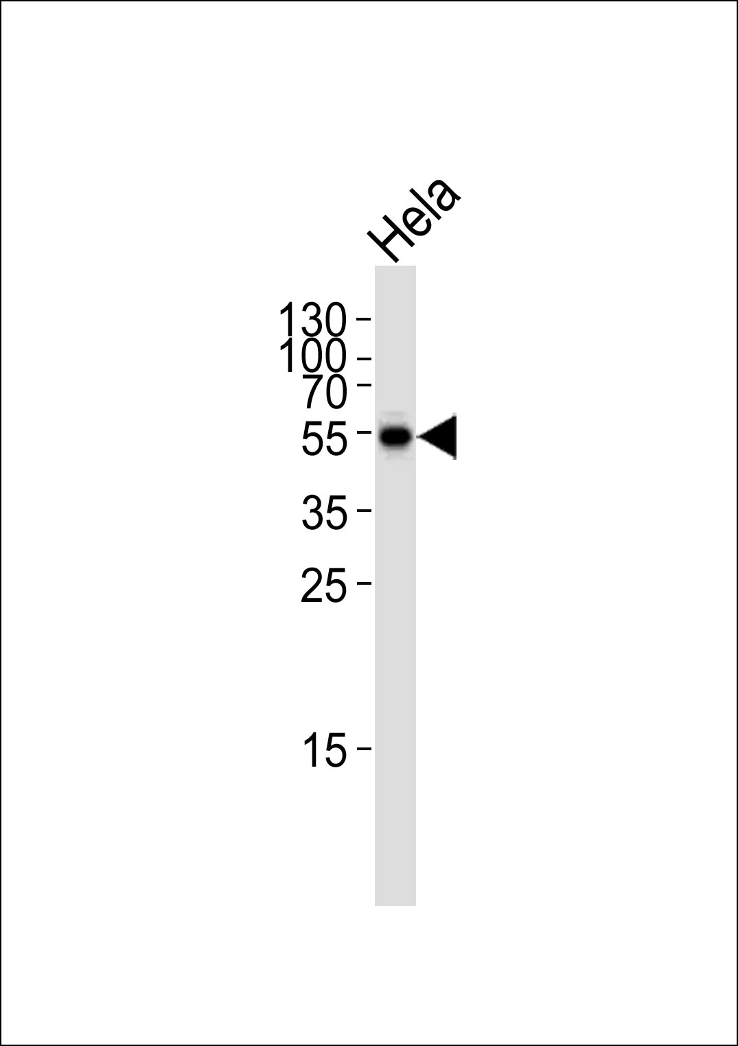 ARG55696 anti-Glutaminase antibody WB image Western blot: 35 µg of HeLa cell line stained with ARG55696 anti-Glutaminase antibody at 1:1000 dilution.
